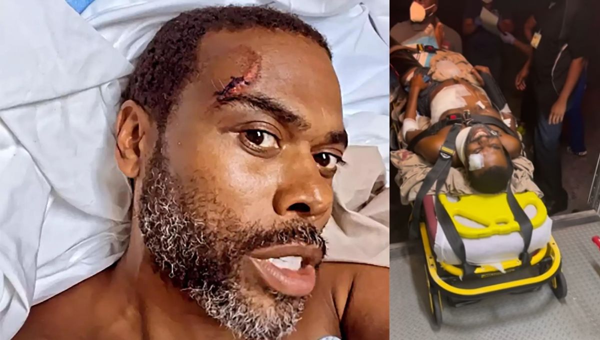 Comedian Lil Duval Airlifted To Hospital After Being Hit By A Car While On ATV