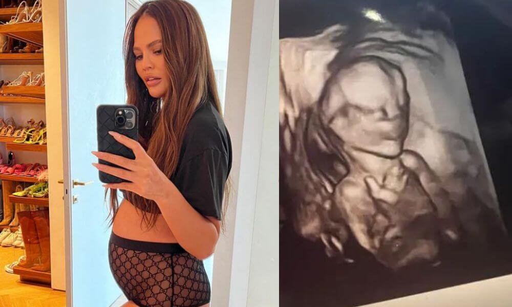 Chrissy Teigen Trolls Donald Trump With Her Baby's First Ultrasound Picture