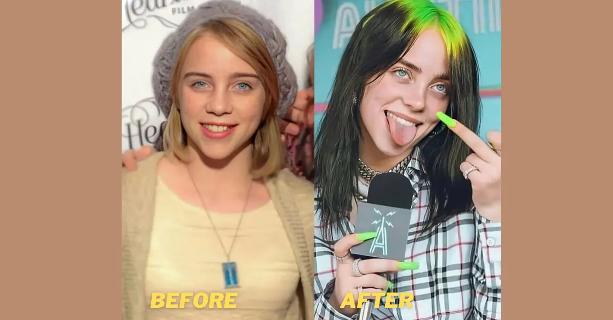 Billie Eilish Before and After Her Weight Loss